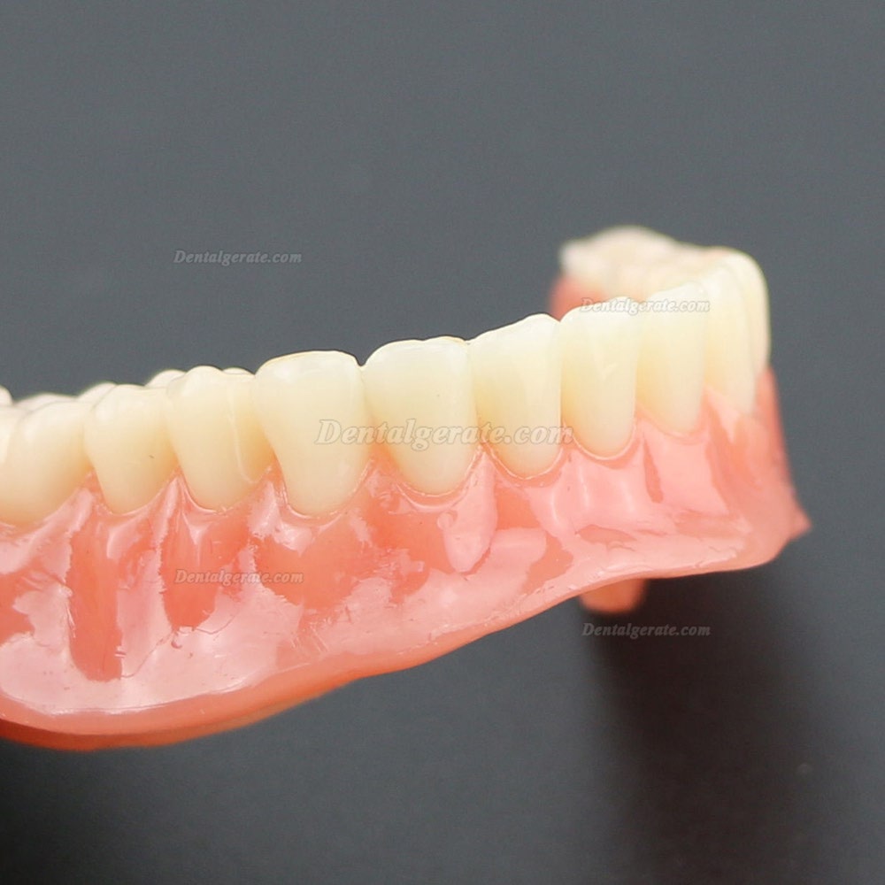 Dental Lower Z&auml;hne Demo-Studienmodell 6002 02 Overdenture Unten 4 Implantate